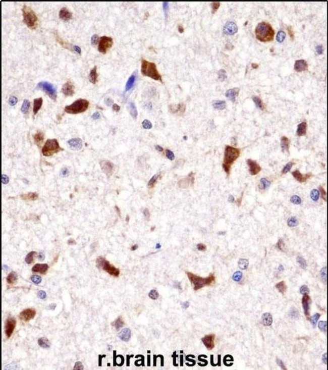 HOXA7 Antibody in Immunohistochemistry (IHC)