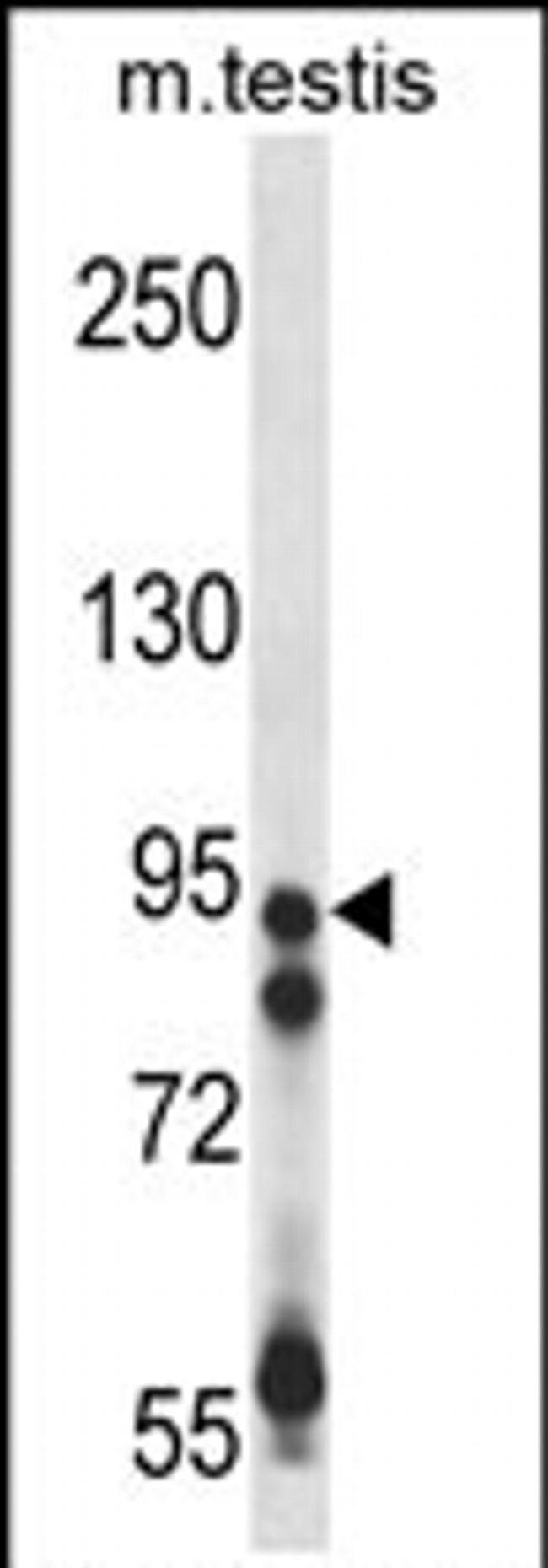 USP20 Antibody in Western Blot (WB)