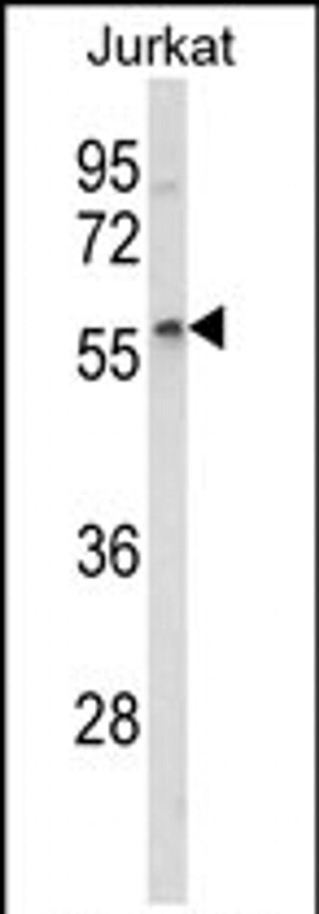 SPRED1 Antibody in Western Blot (WB)