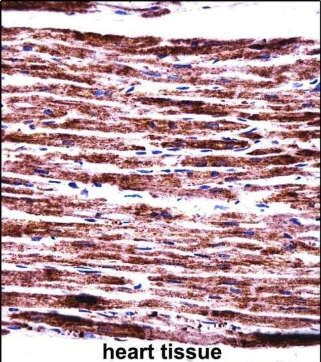 PERP Antibody in Immunohistochemistry (IHC)