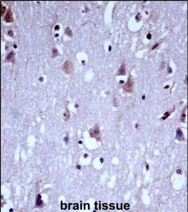 KV3.1 (KCNC1) Antibody in Immunohistochemistry (IHC)
