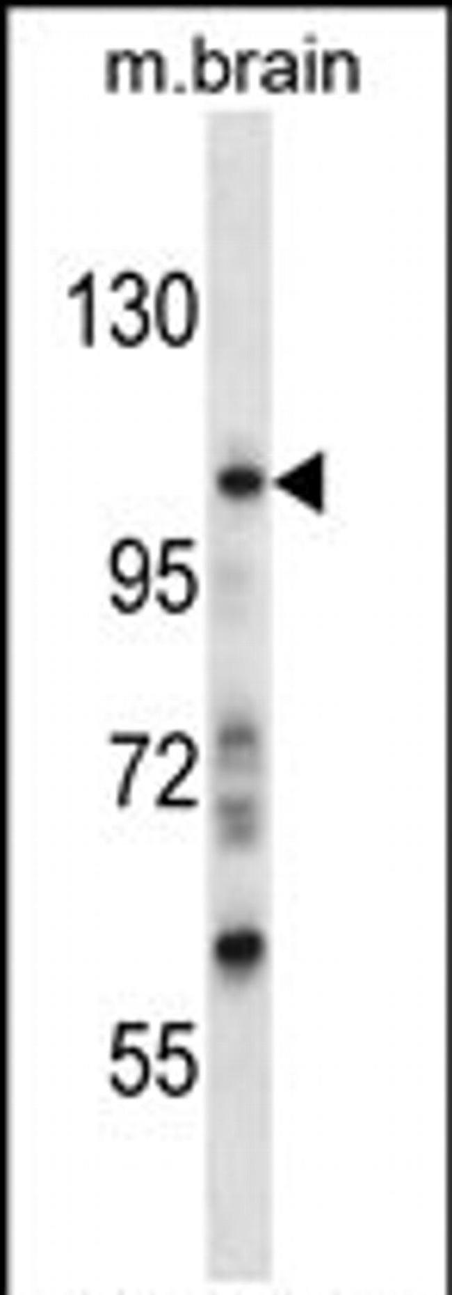 SGK223 Antibody in Western Blot (WB)