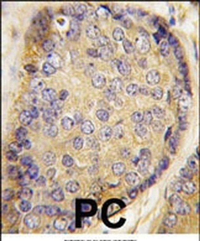 Latexin Antibody in Immunohistochemistry (IHC)