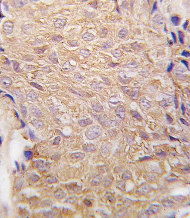 ALDH6A1 Antibody in Immunohistochemistry (IHC)