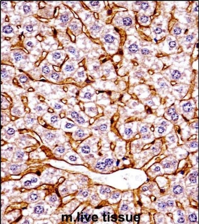 GCN2 Antibody in Immunohistochemistry (IHC)