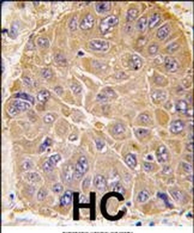 ALDH5A1 Antibody in Immunohistochemistry (IHC)
