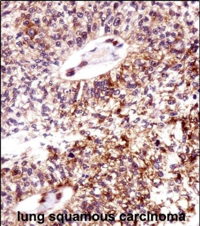 ECT2 Antibody in Immunohistochemistry (IHC)