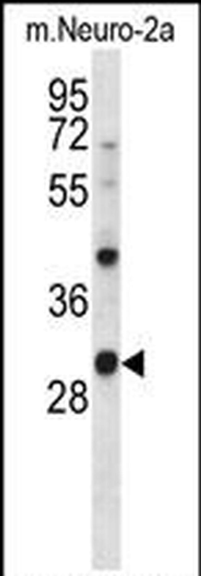 CK1 alpha Antibody in Western Blot (WB)