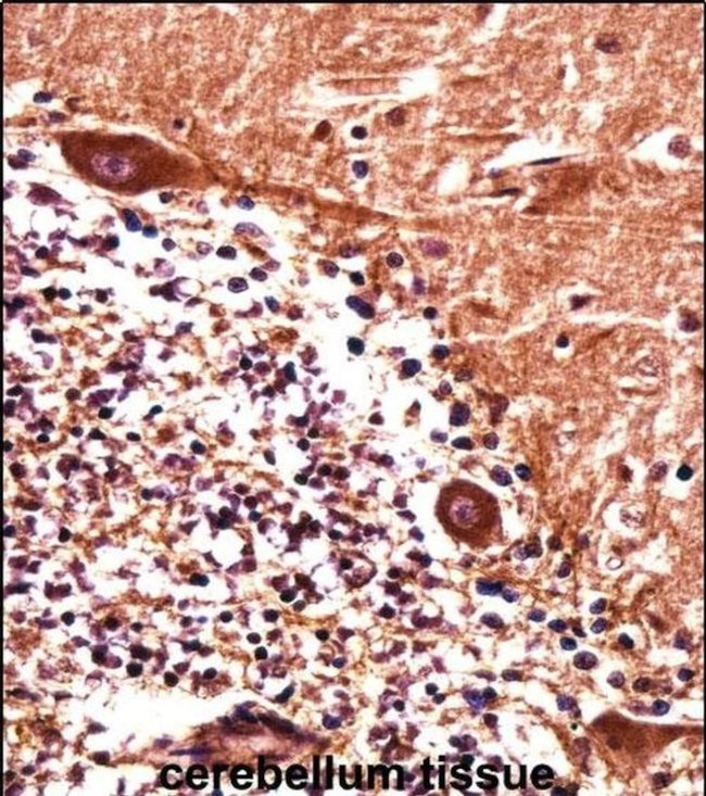 PJA Antibody in Immunohistochemistry (IHC)
