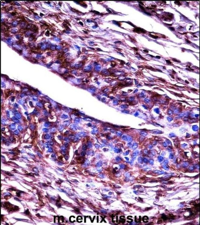 GRK3 Antibody in Immunohistochemistry (IHC)