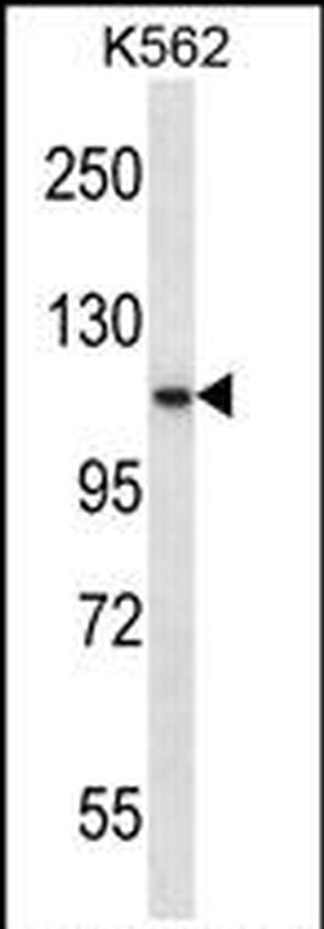 PCSK6 Antibody in Western Blot (WB)