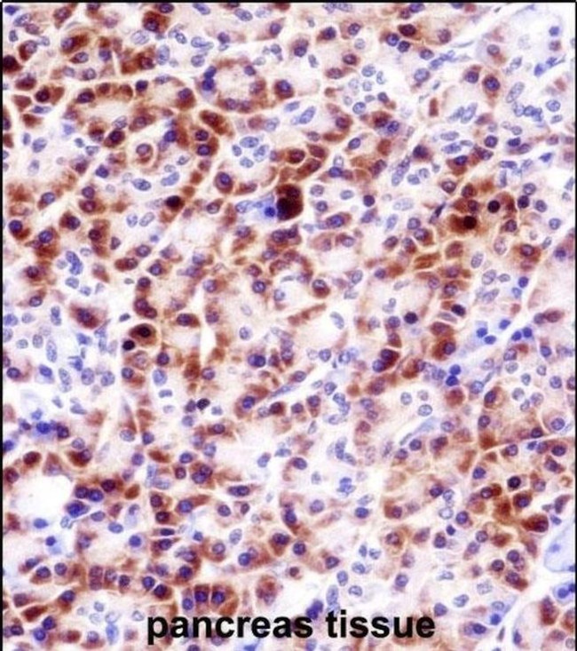 PRSS27 Antibody in Immunohistochemistry (IHC)