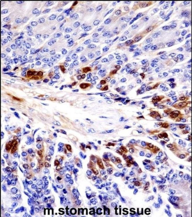 PEAK1 Antibody in Immunohistochemistry (IHC)