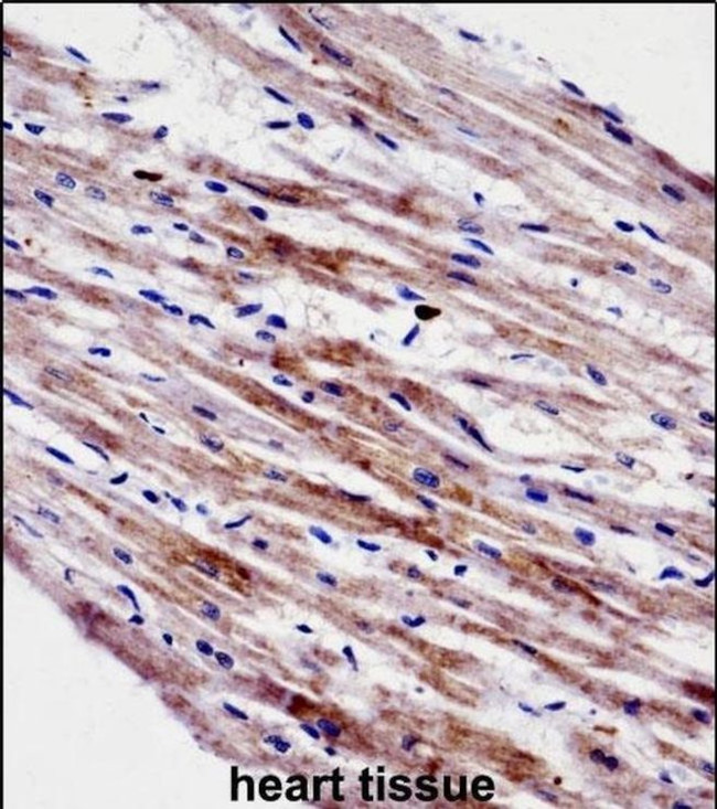 Cardiotrophin 1 Antibody in Immunohistochemistry (IHC)