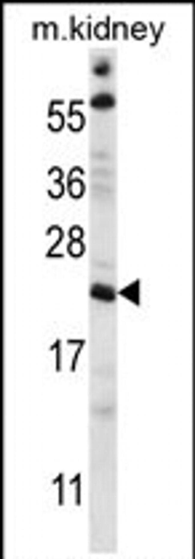 TTC33 Antibody in Western Blot (WB)