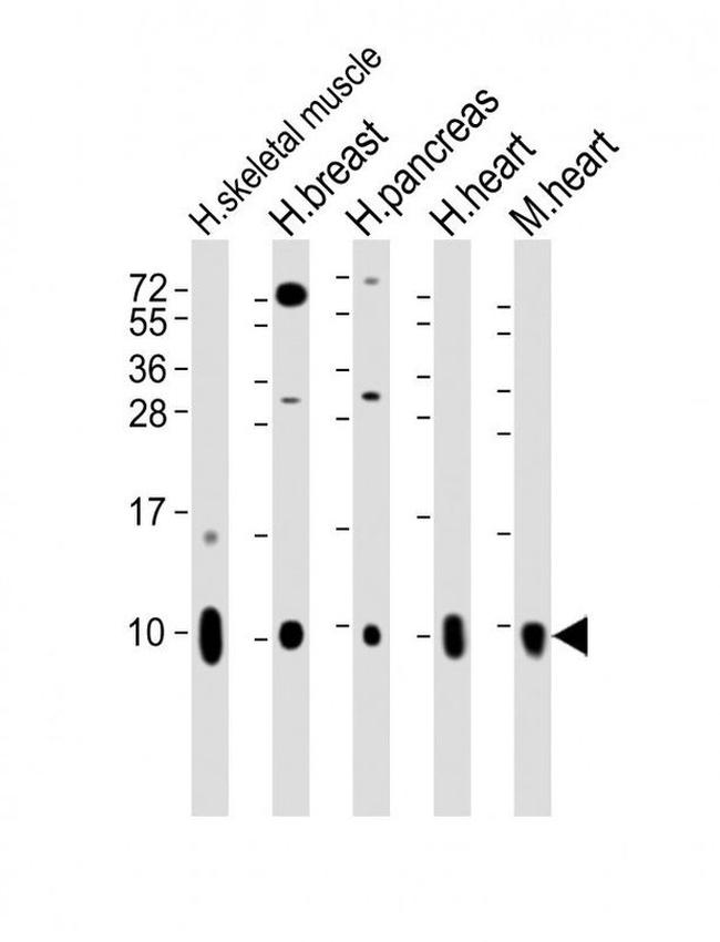 COX7A1 Antibody in Western Blot (WB)