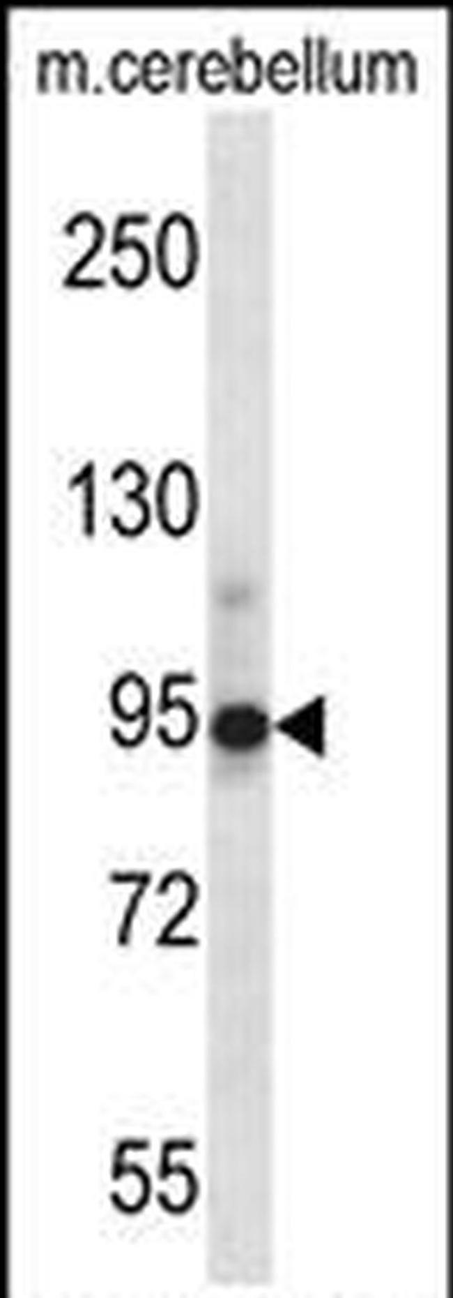 Chordin Antibody in Western Blot (WB)