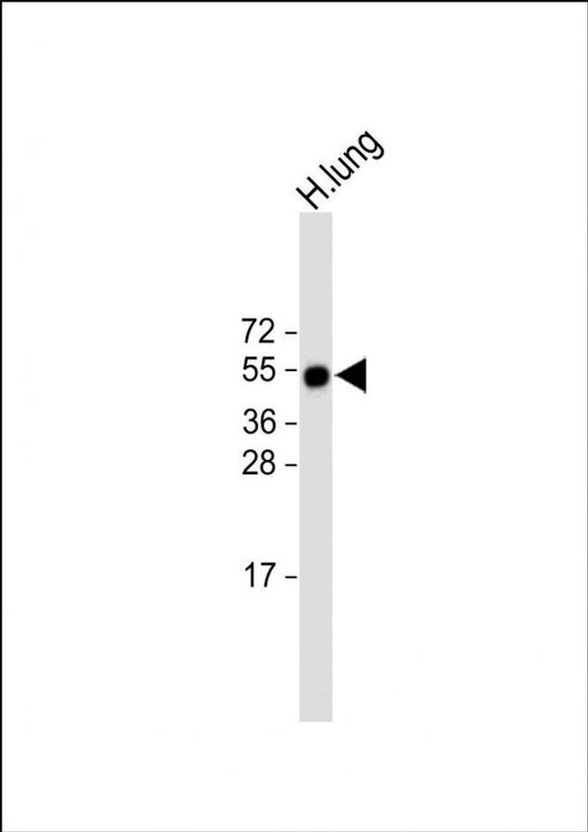 RAMP3 Antibody in Western Blot (WB)