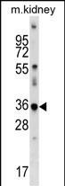 CDKL4 Antibody in Western Blot (WB)