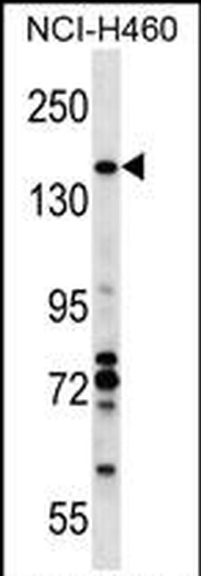 VCPIP1 Antibody in Western Blot (WB)