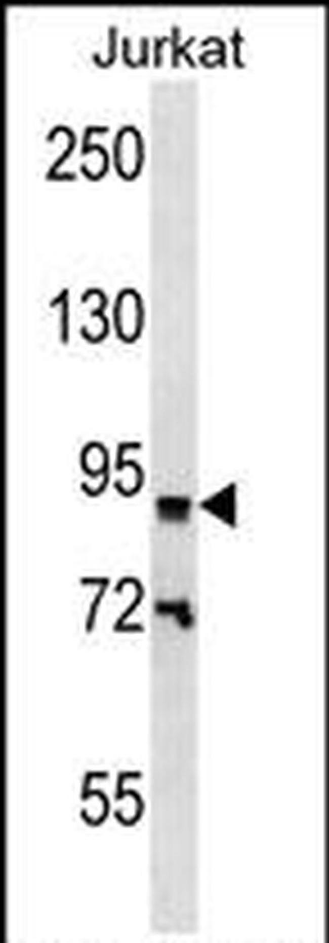 ZNF780B Antibody in Western Blot (WB)