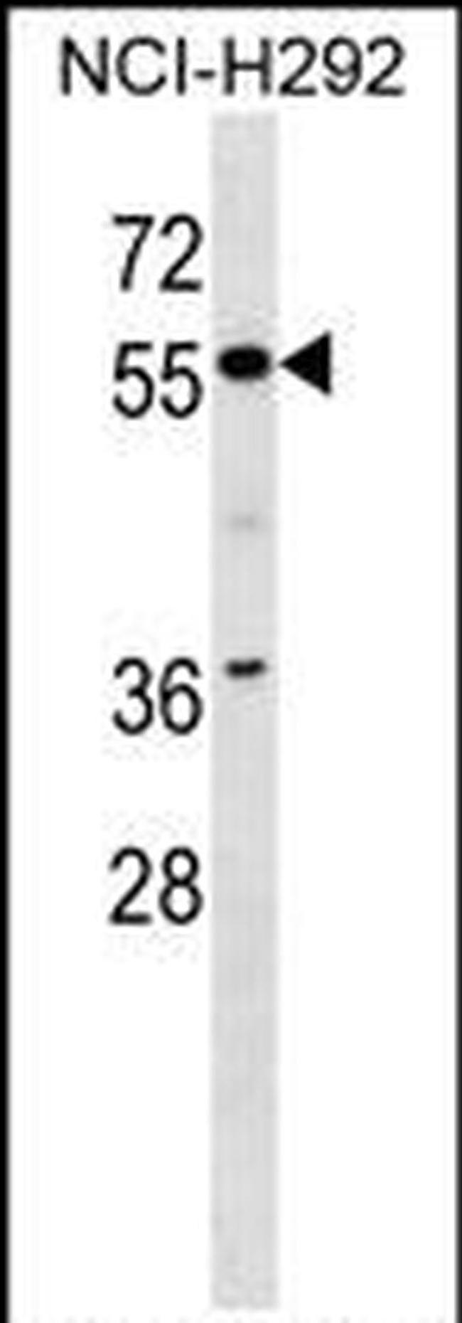 ZNF512 Antibody in Western Blot (WB)