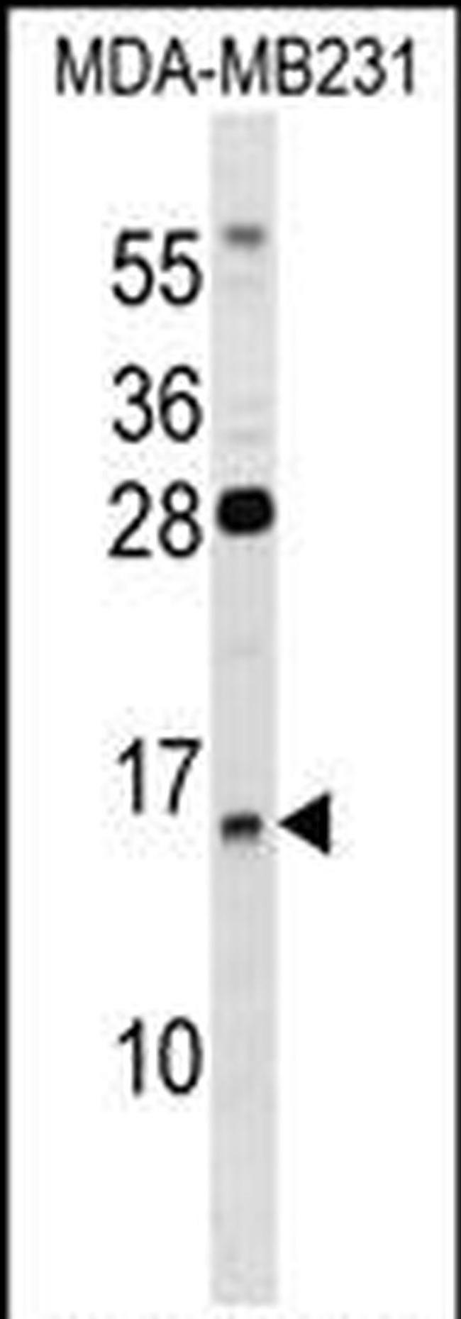 GUCA2B Antibody in Western Blot (WB)