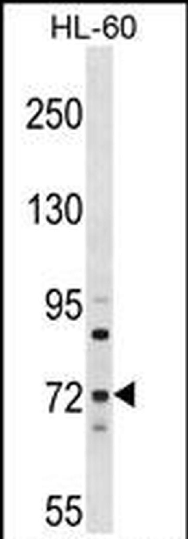 MTMR6 Antibody in Western Blot (WB)