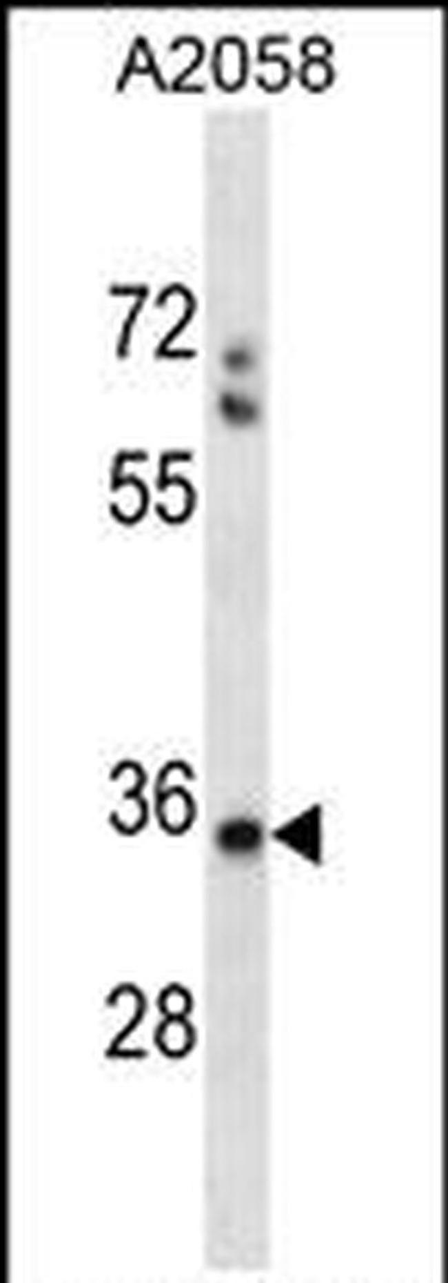 SPEM1 Antibody in Western Blot (WB)