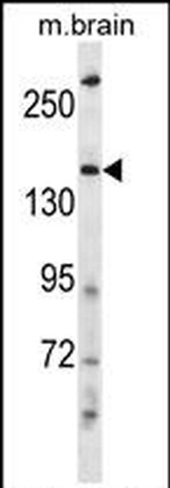 NEDL2 Antibody in Western Blot (WB)