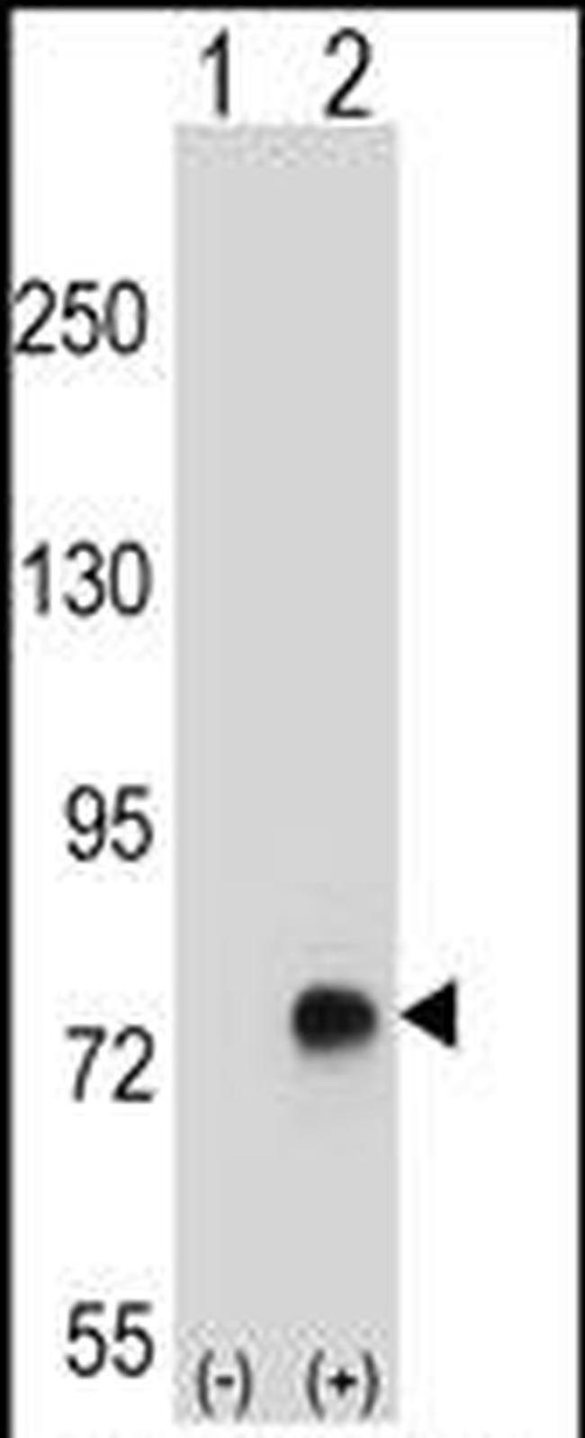 TGFBI Antibody in Western Blot (WB)