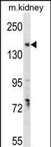 GREB1 Antibody in Western Blot (WB)