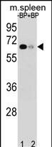 ASB3 Antibody in Western Blot (WB)