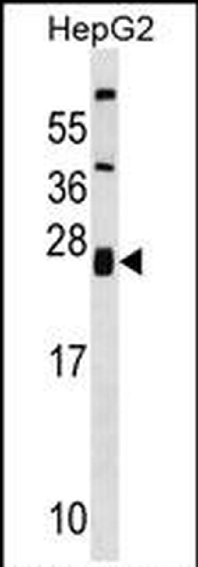 ZNRF1 Antibody in Western Blot (WB)