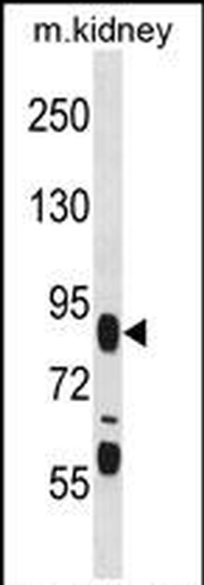FIGN Antibody in Western Blot (WB)