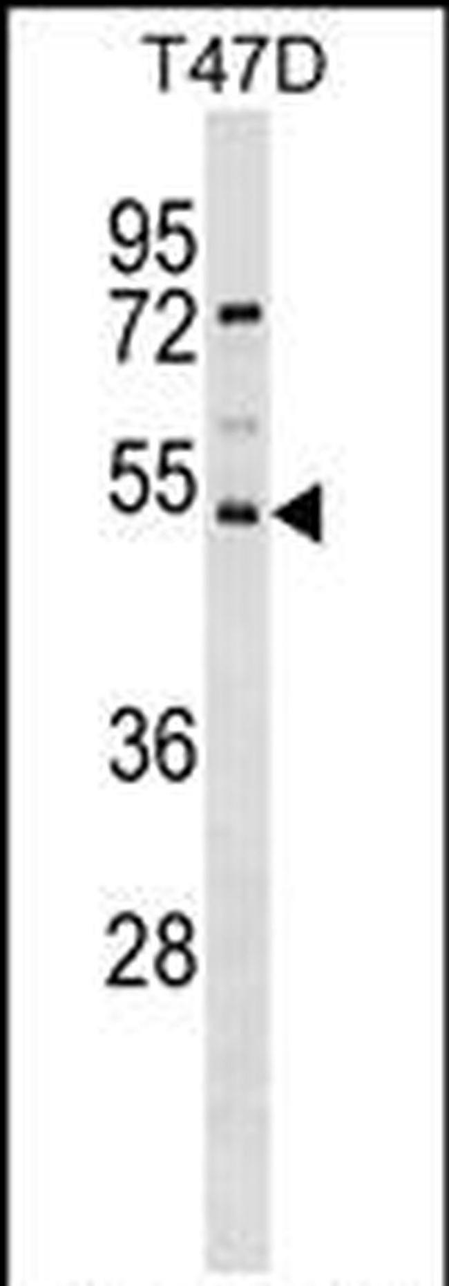 SVOPL Antibody in Western Blot (WB)