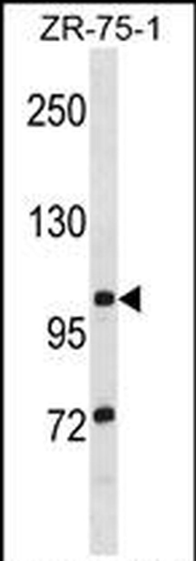 TTLL8 Antibody in Western Blot (WB)