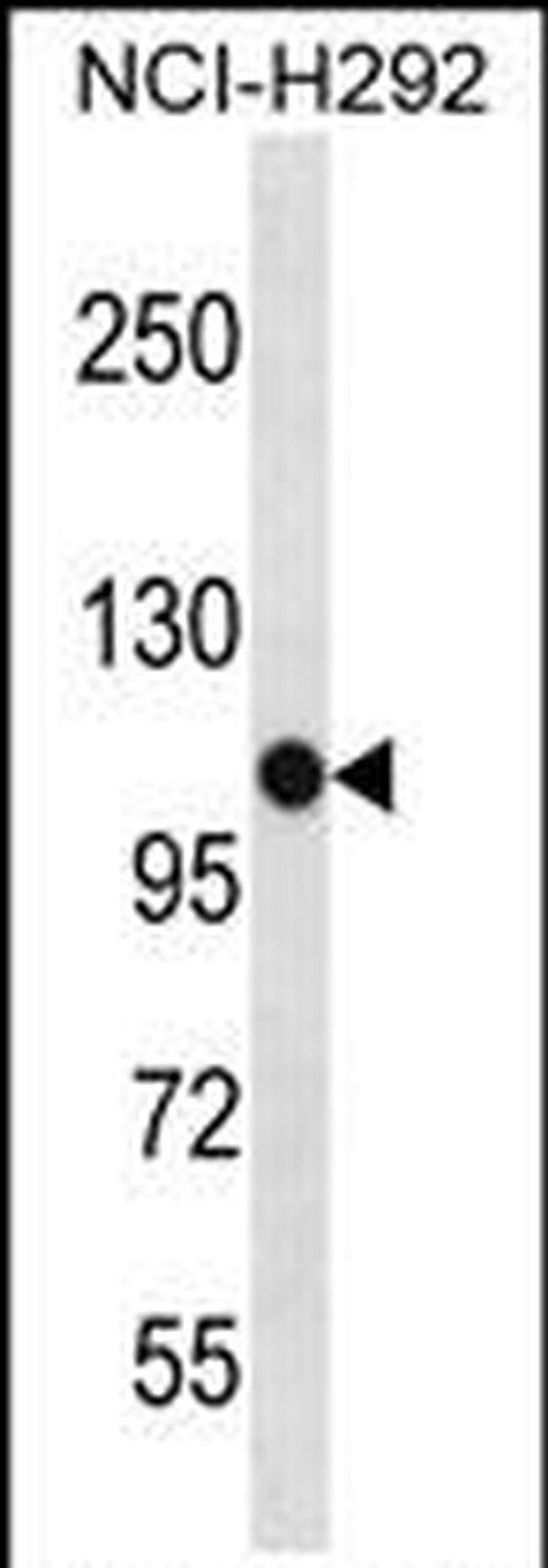PBXIP1 Antibody in Western Blot (WB)