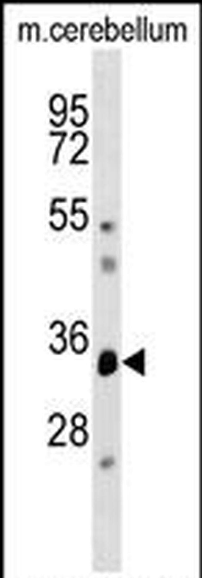 DUSP12 Antibody in Western Blot (WB)
