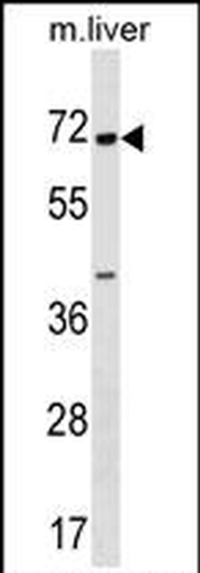 CPNE6 Antibody in Western Blot (WB)