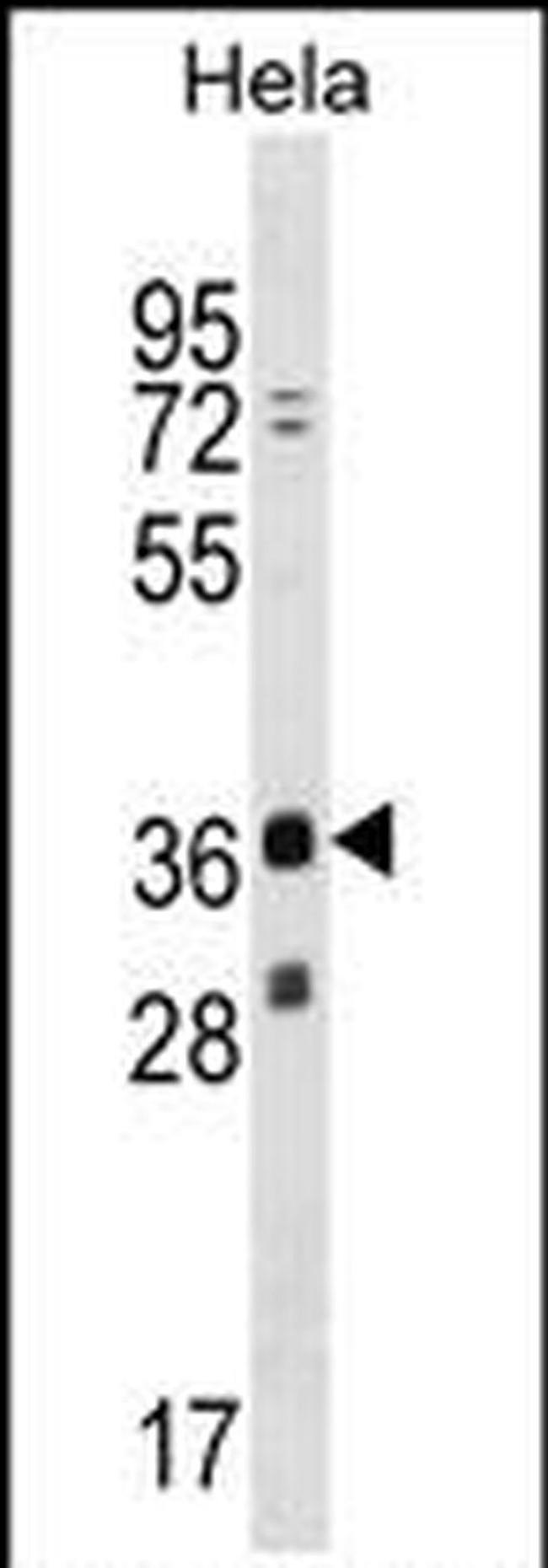 MAGEB16 Antibody in Western Blot (WB)