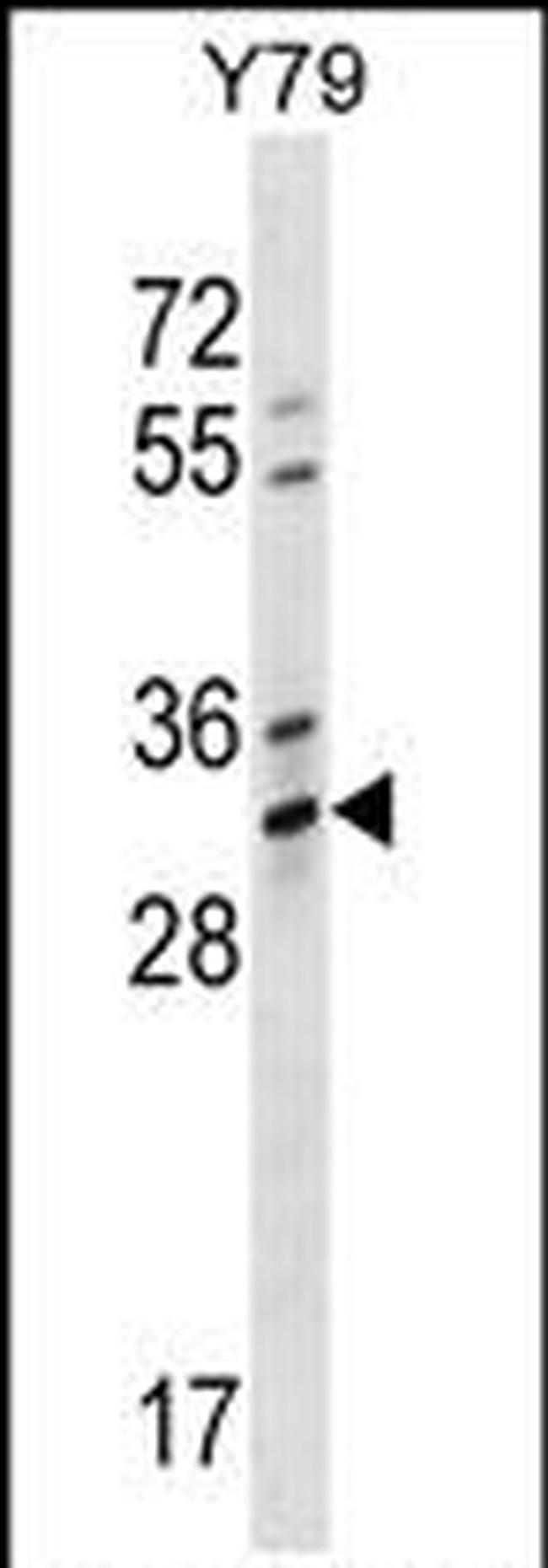 OR4K1 Antibody in Western Blot (WB)