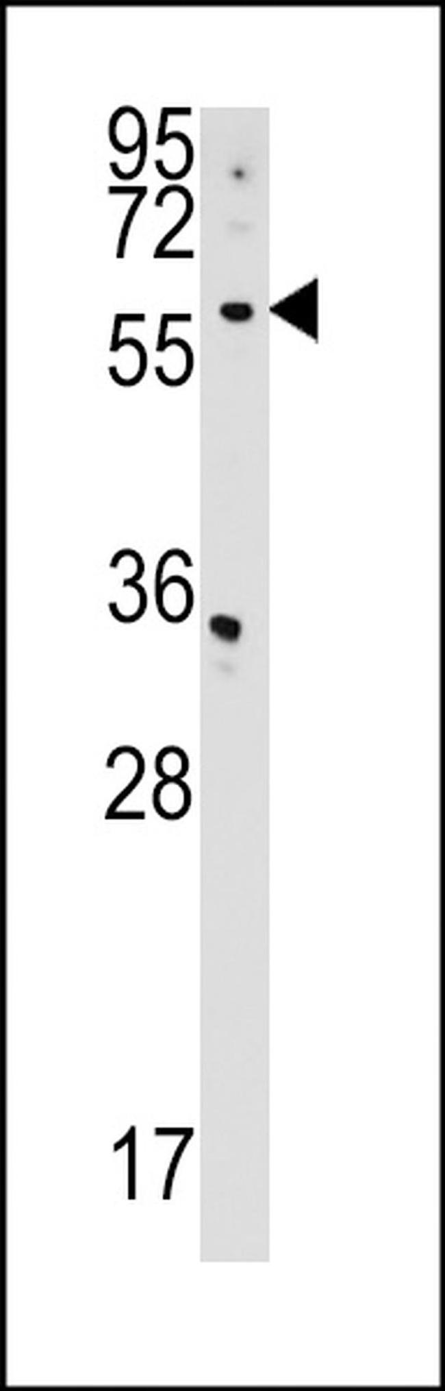 CDS2 Antibody in Western Blot (WB)