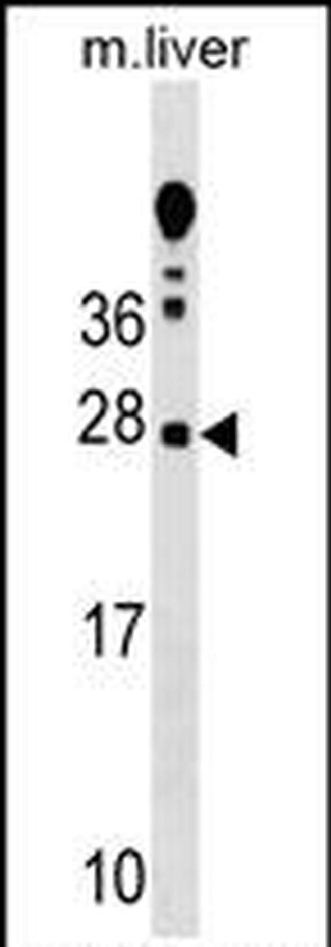 TRIM Antibody in Western Blot (WB)