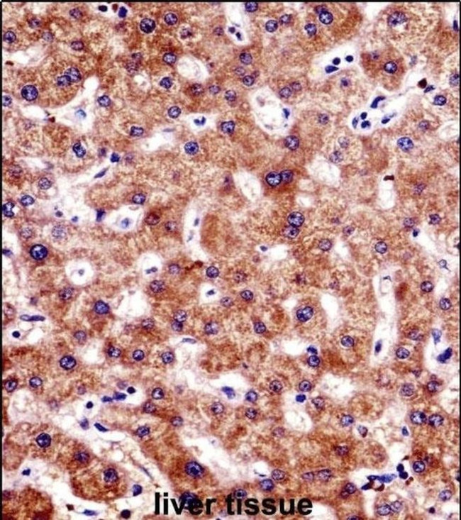 BCL7B Antibody in Immunohistochemistry (IHC)