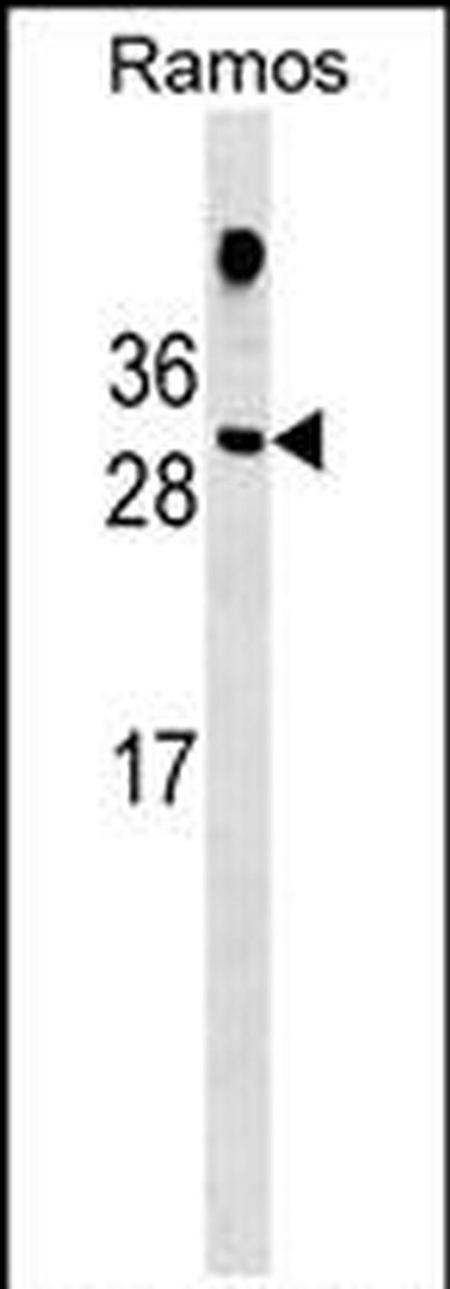 HDGFL1 Antibody in Western Blot (WB)