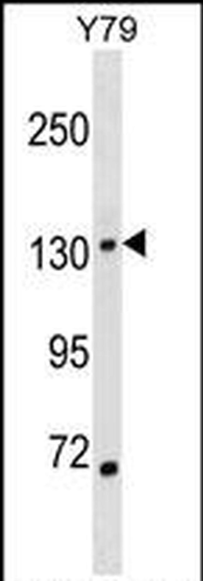 SALL1 Antibody in Western Blot (WB)