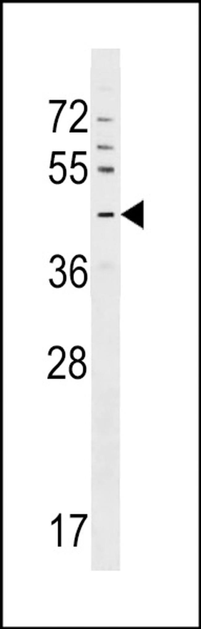 GPR63 Antibody in Western Blot (WB)