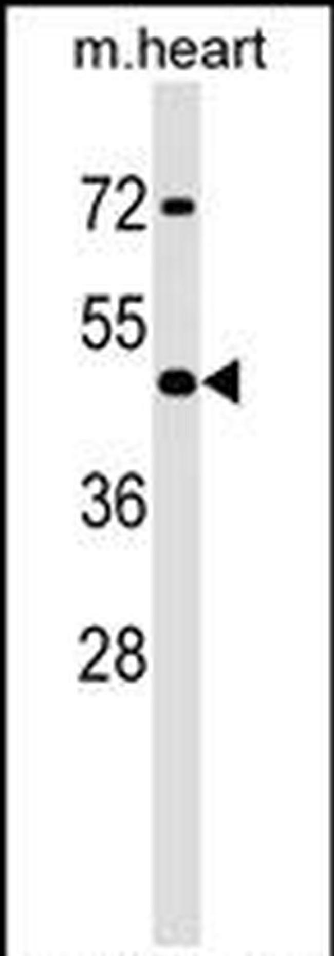HOXA2 Antibody in Western Blot (WB)