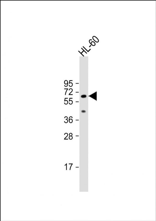 AOAH Antibody in Western Blot (WB)